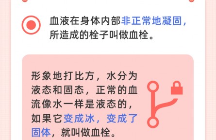 世界血栓日：血栓最易“栓”住哪些人？