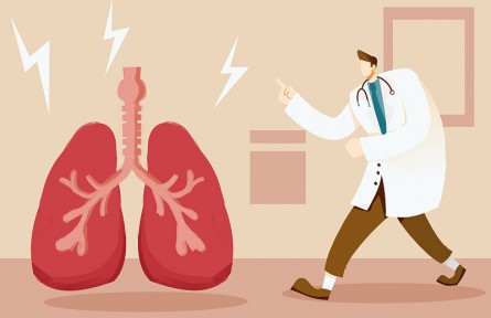 科技名詞 | 肺結節(jié) pulmonary nodule