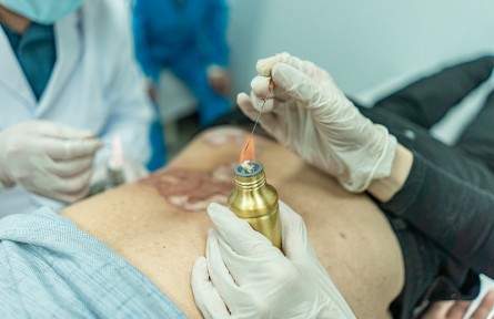 科技名詞|火針療法 fire needle therapy；puncturing point with hot-red needle